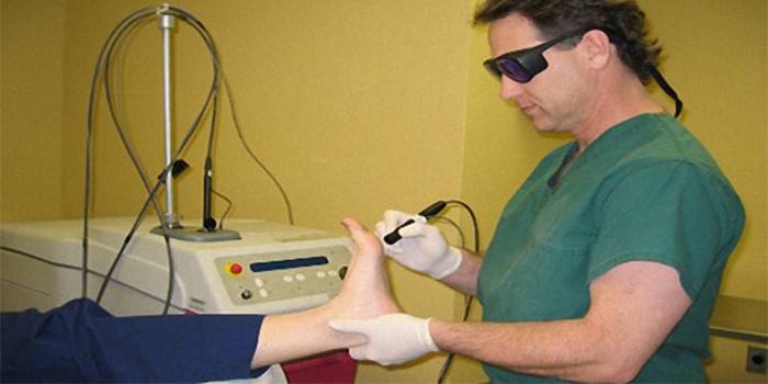 Bác sĩ cắt lưỡi trên bàn chân bệnh nhân bằng tia laser