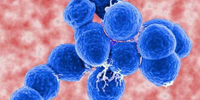 Virusul Streptococcus la microscop