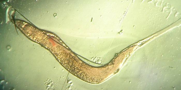 Photo d'oxyure sous le microscope