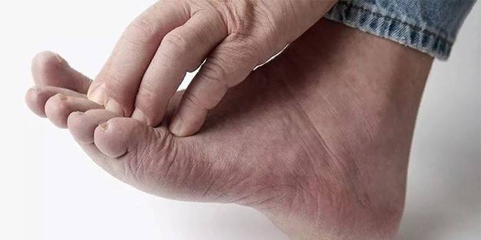 Người đàn ông chân ngứa.
