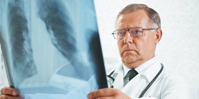 Doktor überprüft einen Röntgenstrahl der Lungen