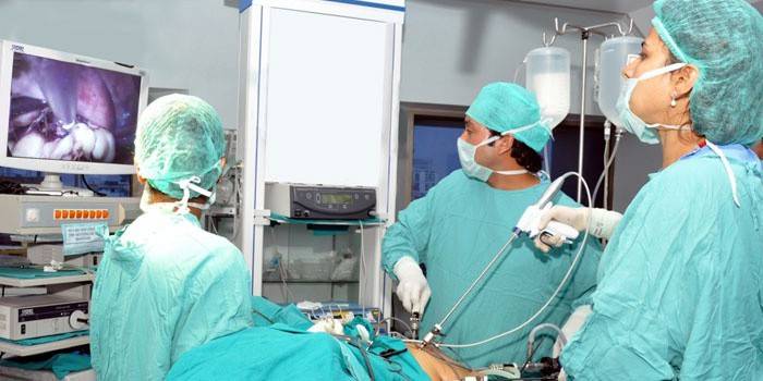 Οι γιατροί εκτελούν λαπαροσκοπική χειρουργική επέμβαση