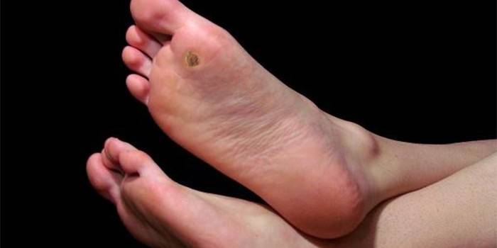 Cani ai piedi di un uomo