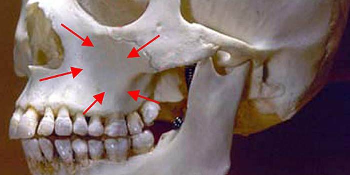 La posizione del seno mascellare sul cranio umano