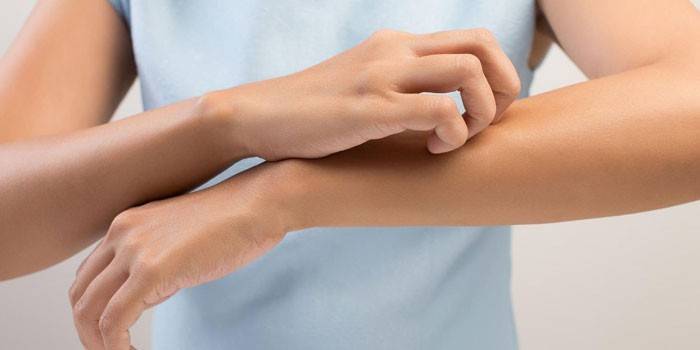 La ragazza si gratta la pelle della mano