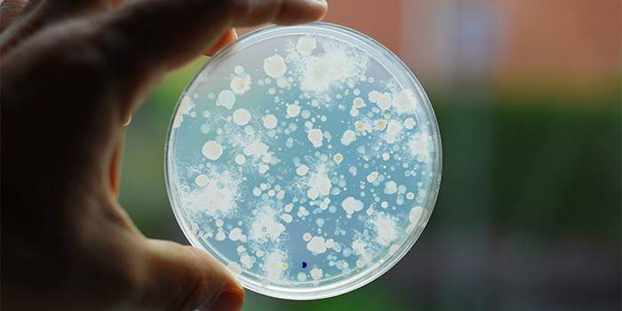 Prato de Petri com Candida Albicans
