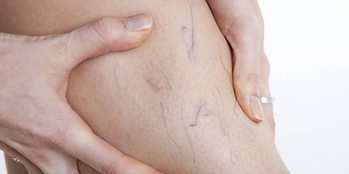 Xarxa vascular a la cama de la dona
