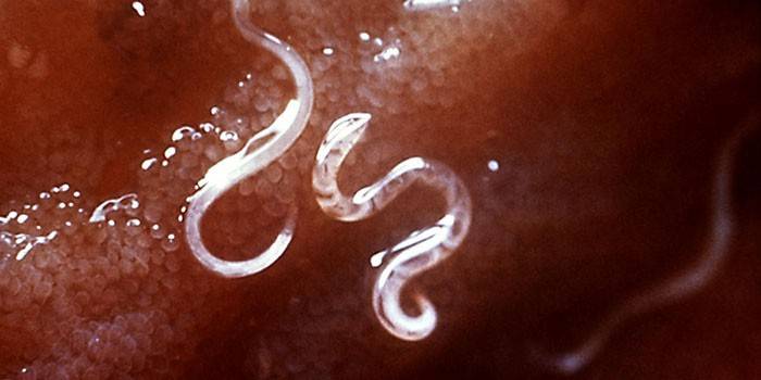 Pinworms žmogaus audiniuose