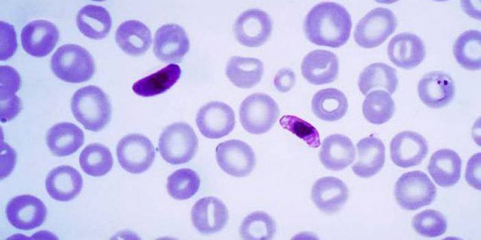 Infecția cu Negleria Falserului