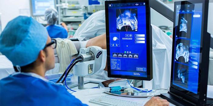 Il medico esegue l'ablazione della prostata