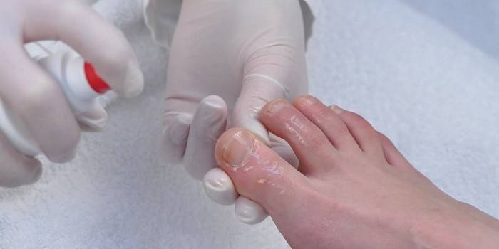 Tratamiento de uñas en aerosol