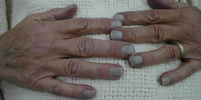 ตัวเขียวผิวมือ