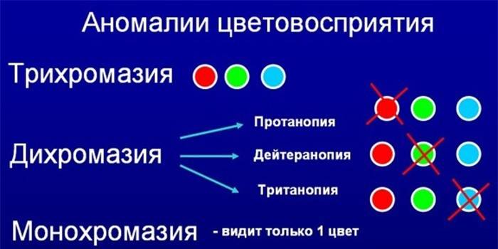 ความผิดปกติของสี