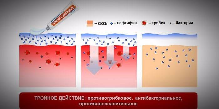 The effect of mycoderil on the skin