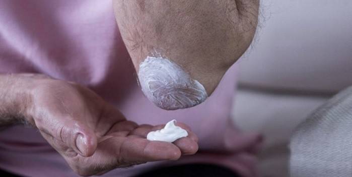 Applicazione di unguento