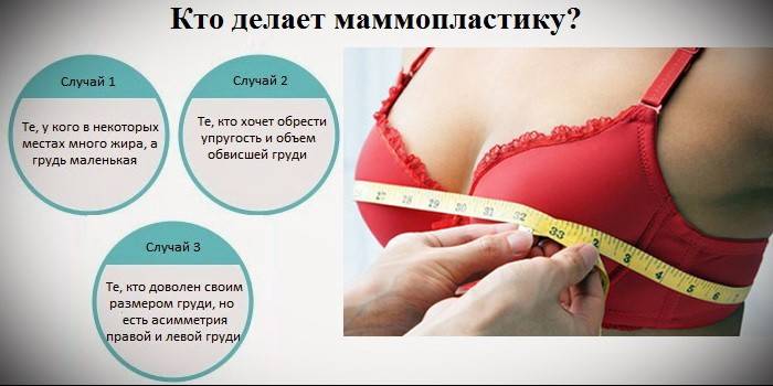 Показания за мамопластика
