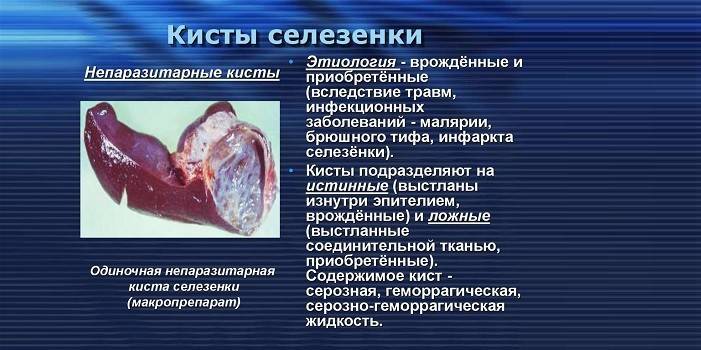 Кисти на далака