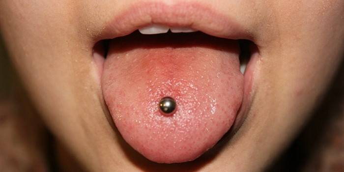 Lengua perforada