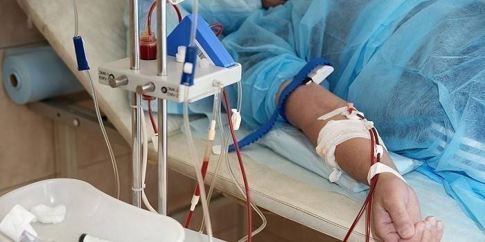 Catheter Hand Pacient