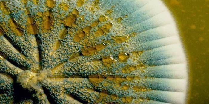 Molde de penicilina sob o microscópio