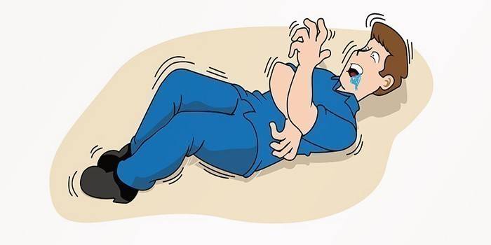 Crizele epileptice