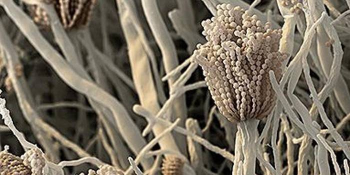 Grybelinis alergenas aspergillus fumigatus