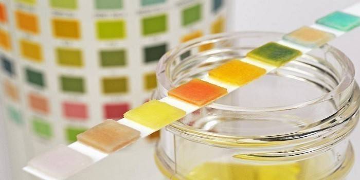 Entschlüsselung der Urinanalyse
