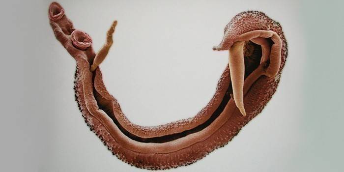 Schistosoma