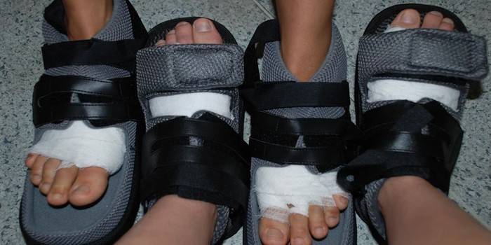 Chaussures de rééducation postopératoires