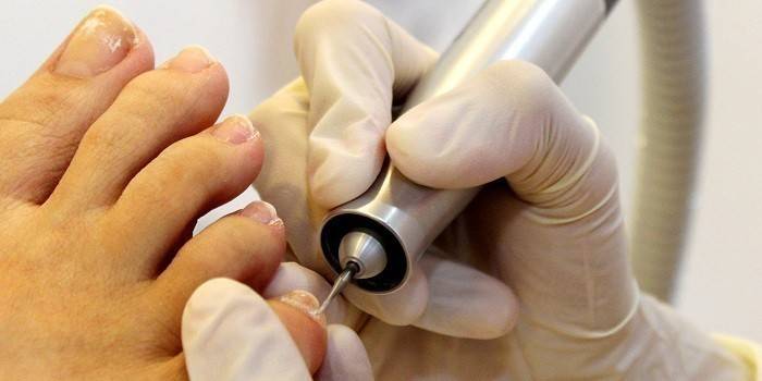 Medic fait pédicure de matériel médical