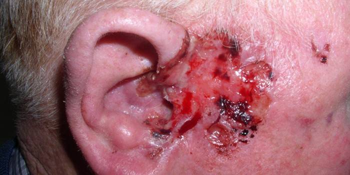 Oncologia sul viso