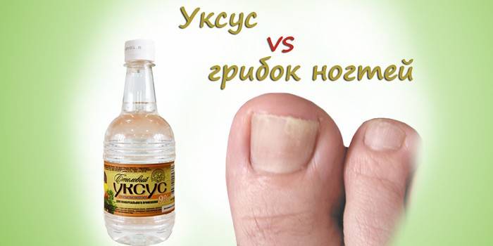 Nagu sēnīšu etiķis