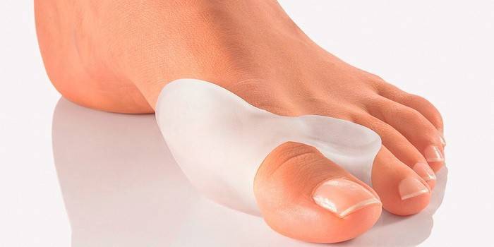 Coussinets orthopédiques interdigitaux