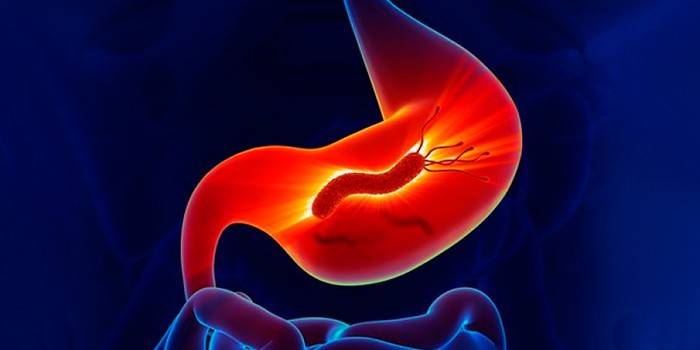Infezione da Helicobacter pylori