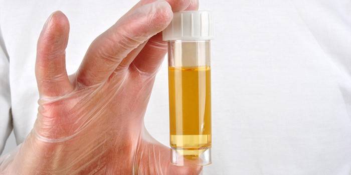 Vizelet in vitro