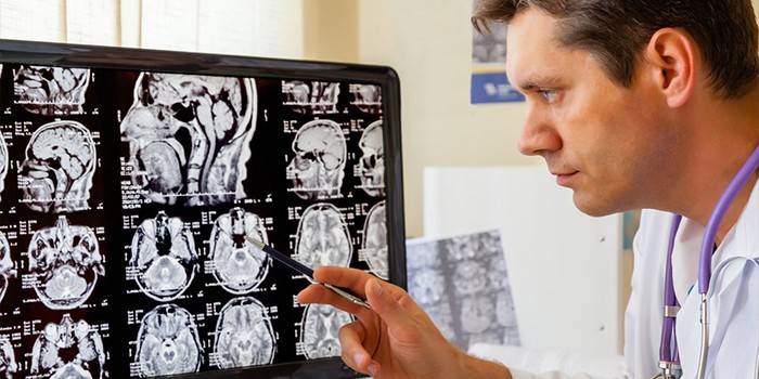 Medicul examinează imaginile stratificate ale creierului uman de pe un monitor