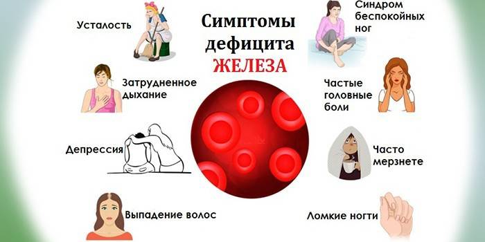Vashiány tünetei