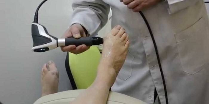 Le médecin effectue une thérapie par ondes de choc