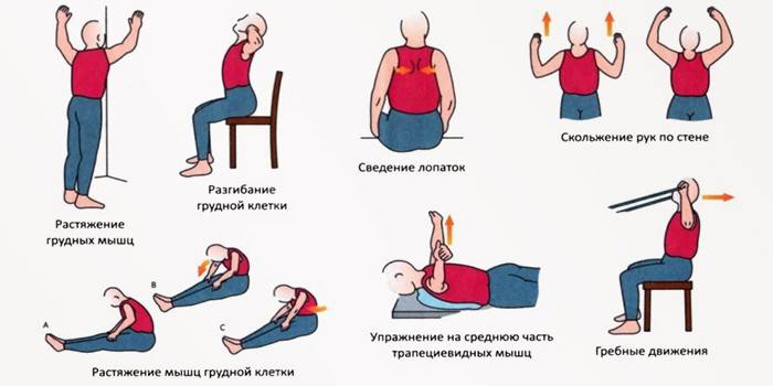 Ćwiczenia na osteochondroza szyjki macicy
