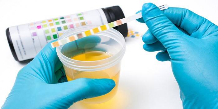 Labor für Urinanalyse
