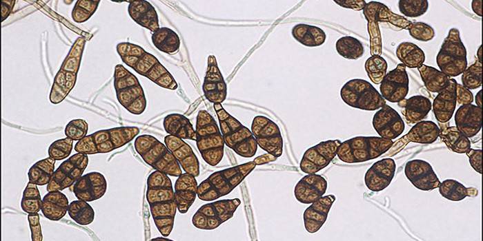 Alternaria grybelio plitimas