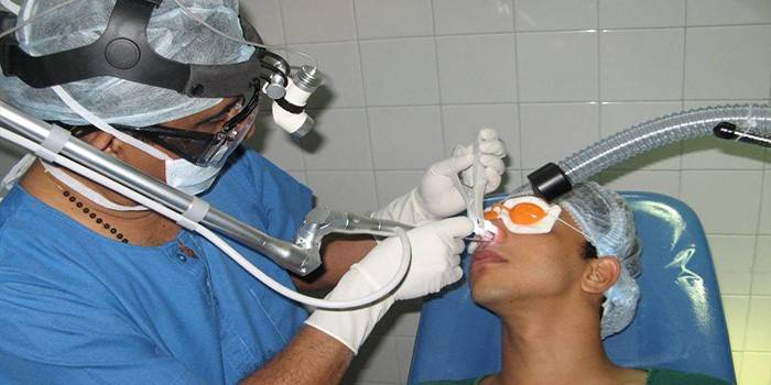 Trattamento laser