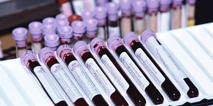Δοκιμές αίματος in vitro