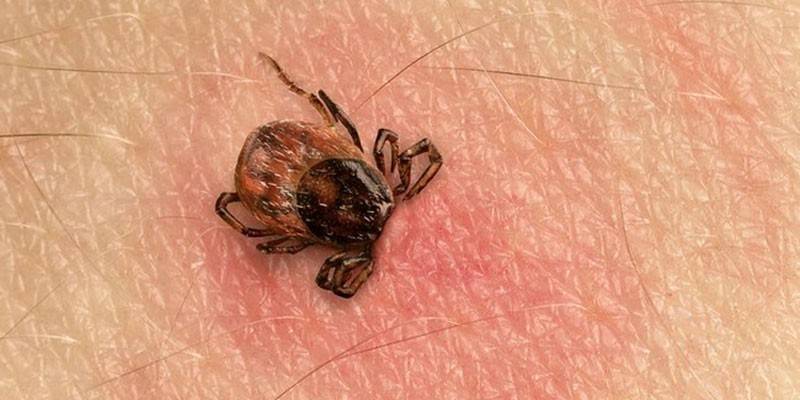 Tick on human body