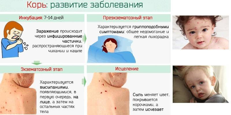 Развој болести