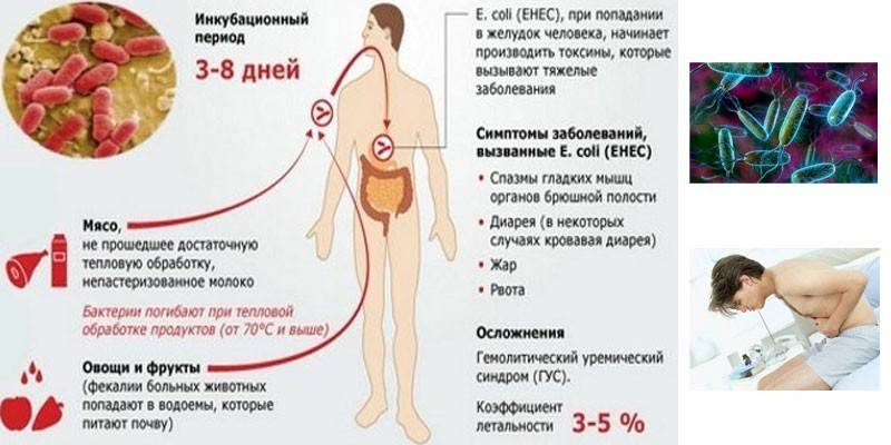 Escherichioosi: oireet ja komplikaatiot
