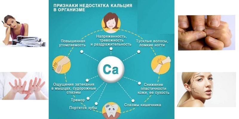 Merkkejä elementin puutteesta