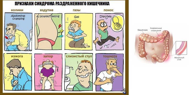 Συμπτώματα του IBS