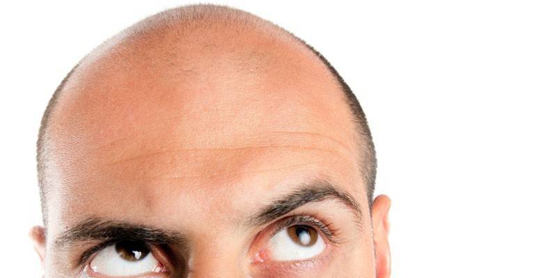 Ο άνθρωπος του Balding