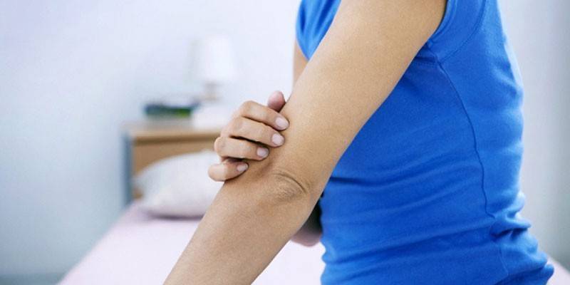 Ακατέργαστο δέρμα στον αγκώνα μιας γυναίκας